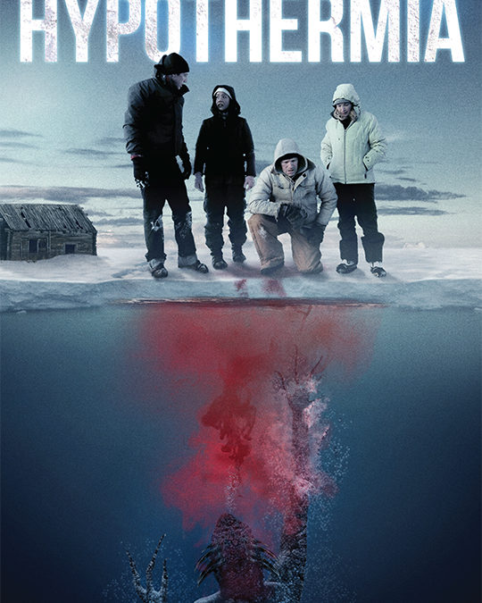 Hypothermia
